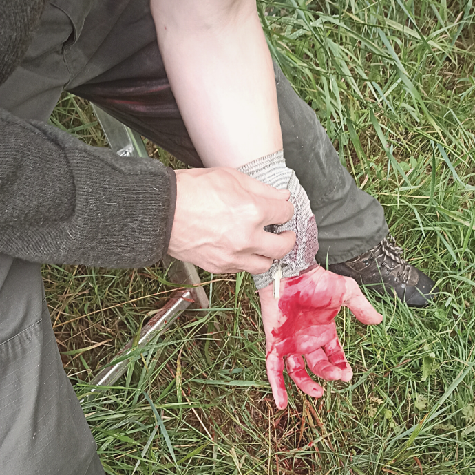 Ein adäquates Erste-Hilfe-Training für Jägerinnen und Jäger ist von hoher Bedeutung, da es ihnen ermöglicht, in Notfällen angemessen zu reagieren und Verletzungen sachgerecht zu versorgen. Dies ist besonders wichtig, da Jägerinnen und Jäger häufig in abgelegenen Jagdgebieten unterwegs sind, in denen medizinische Hilfe möglicherweise nicht sofort verfügbar ist.  Das Training vermittelt ihnen spezifische Kenntnisse und Fähigkeiten, um mit Verletzungen wie Schnittwunden, Schussverletzungen oder Stürzen umzugehen. Sie lernen, Blutungen zu stoppen, Wunden zu reinigen und Verbände anzulegen, um den Verletzten stabilisieren zu können, bis professionelle Hilfe eintrifft.  Ein weiterer wichtiger Aspekt ist die Verantwortung gegenüber anderen Jägerinnen und Jägern. In einer Jagdgesellschaft können Unfälle passieren, und es ist entscheidend, dass Jägerinnen und Jäger in der Lage sind, Erste Hilfe zu leisten, um ihre Mitjäger zu unterstützen und ihre Sicherheit zu gewährleisten.  Zusätzlich können sie auch in Situationen mit Wildunfällen involviert sein, bei denen Verletzungen auftreten. Das Erste-Hilfe-Training befähigt sie, schnell und angemessen zu handeln, um sowohl verletzten Personen als auch verletztem Wild zu helfen.  Letztendlich trägt ein solches Training dazu bei, dass Jägerinnen und Jäger ihre Jagdaktivitäten ethisch und verantwortungsbewusst ausüben können. Sie sind in der Lage, erlegtes Wild ordnungsgemäß zu behandeln und sicherzustellen, dass das Fleisch in gutem Zustand ist.  Insgesamt ist ein adäquates Erste-Hilfe-Training für Jägerinnen und Jäger von großer Bedeutung, um in Notfällen wirksam zu handeln, die Sicherheit aller Beteiligten zu gewährleisten und eine verantwortungsvolle Ausübung der Jagd zu ermöglichen.